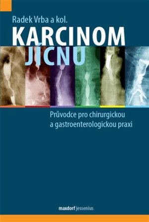Karcinom jícnu - Průvodce pro chirurgickou a gastroenterologickou praxi - VÝPRODEJ